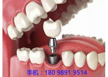 種植牙專業(yè)的進(jìn)出口報關(guān)公司-國際物流進(jìn)口